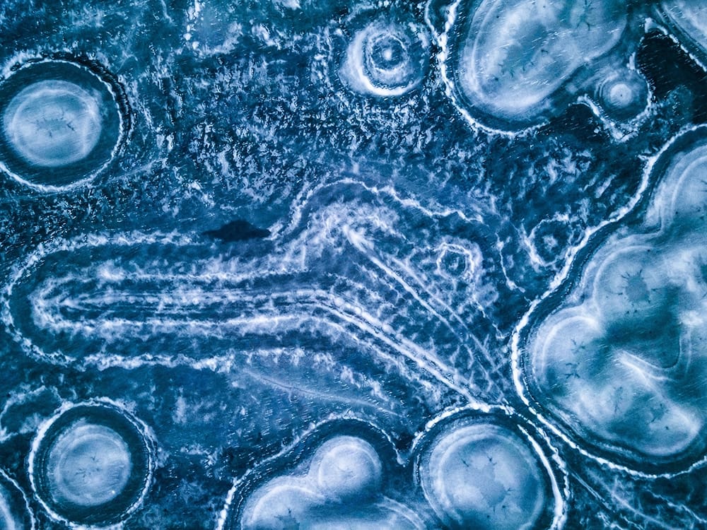 “Stem Cell Research”: Making our Argument in the Midst of Confusion