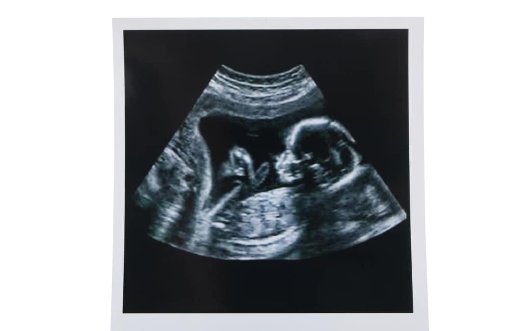 How Do We Know What’s Gained by Ending an Unborn Life?
